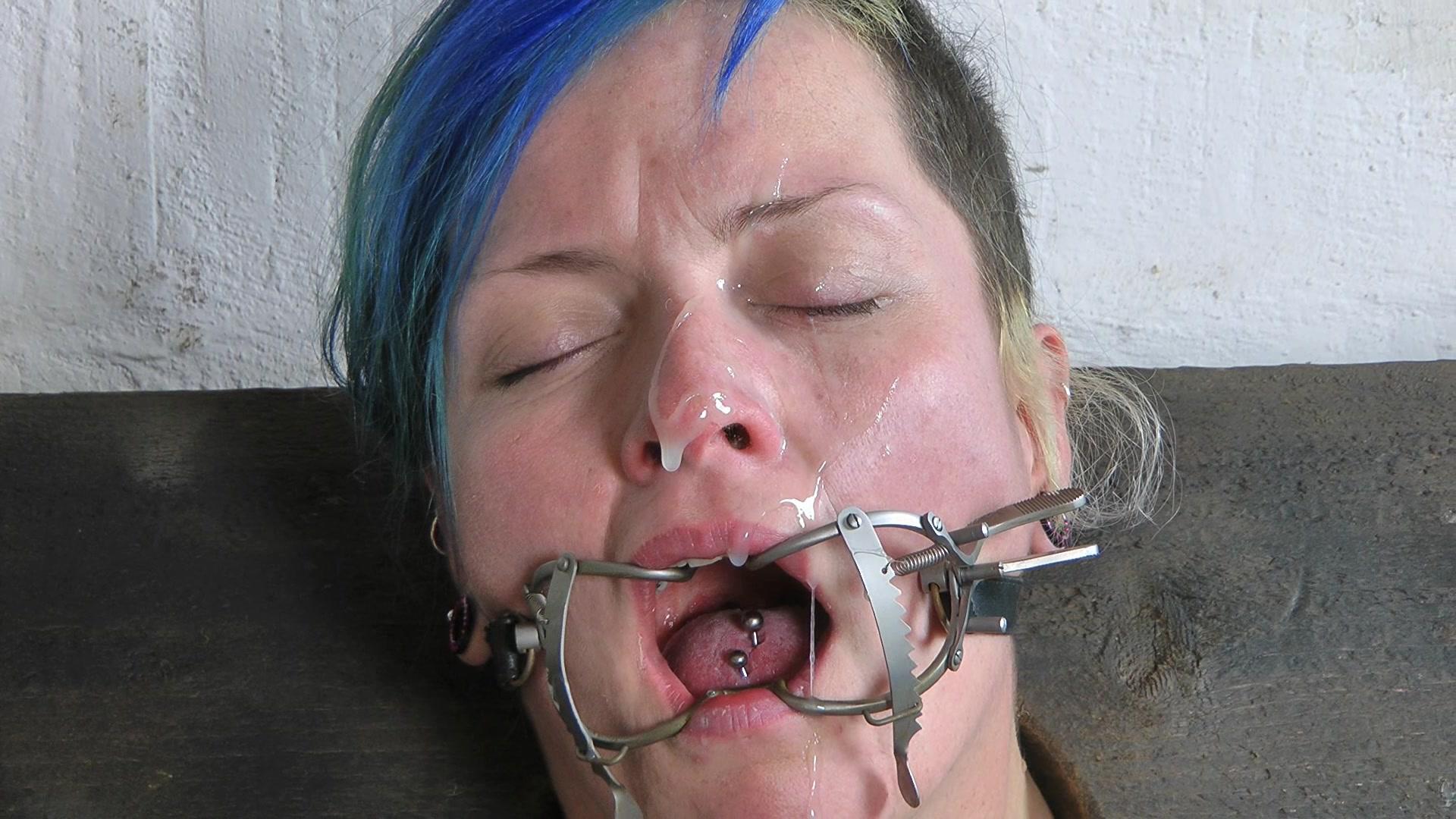 Mouth Opener